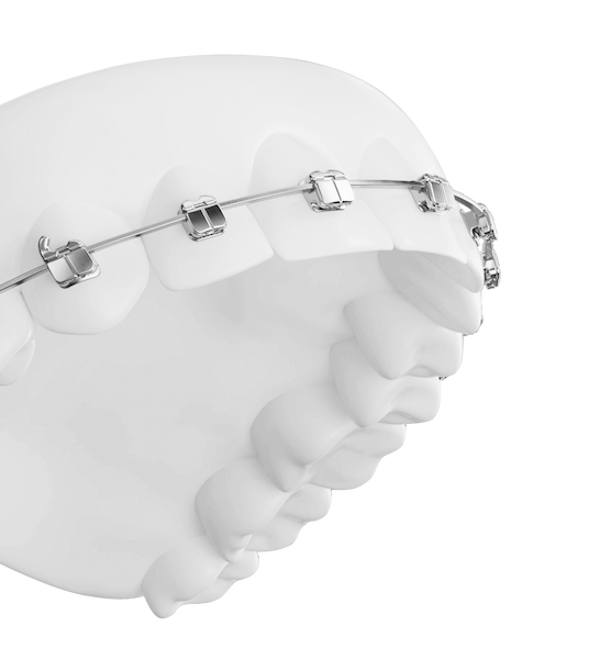 Ортодонтические системы